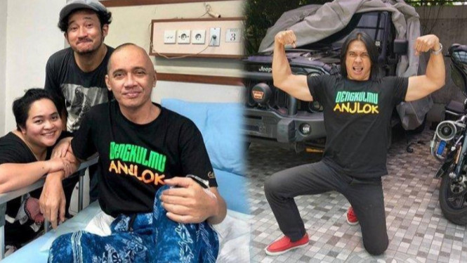 Agung Hercules saat sakit dan semasa sehat.