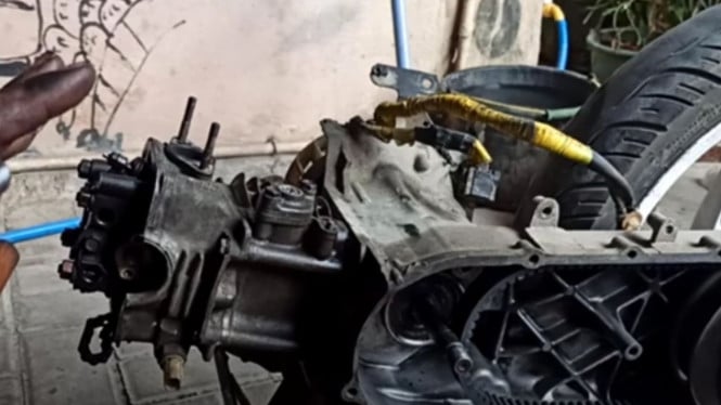 panduan pasang top gigi