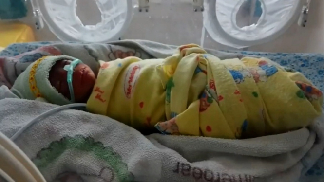 Terlahir Prematur, Bayi Kembar Empat di Rangkasbitung Kritis
