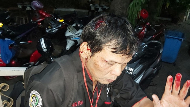 Wartawan Sinar Pagi Jadi Korban Pemukulan Polisi Saat Meliput Aksi Unjuk Rasa