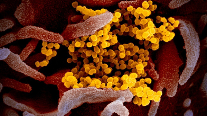 Gawat!!, Riset Menyebut Virus Corona Berpotensi Menginfeksi 2/3 Warga Bumi (Foto Dok. niaid.nih.gov)