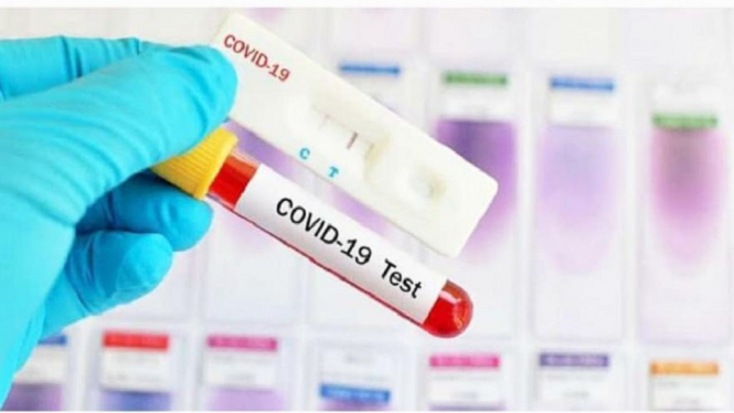 Wabah Virus Corona COVID-19, Begini Cara Penanganan dan Dampaknya (Foto Istimewa)
