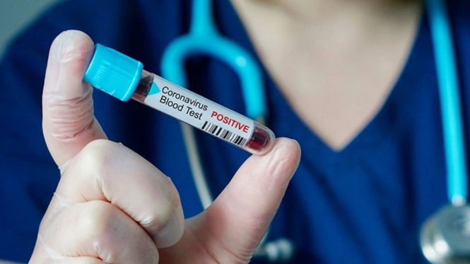 Sudah Ada 6 Jenis Vaksin Virus Corona Diuji Coba di Tubuh Manusia (Foto Istimewa)