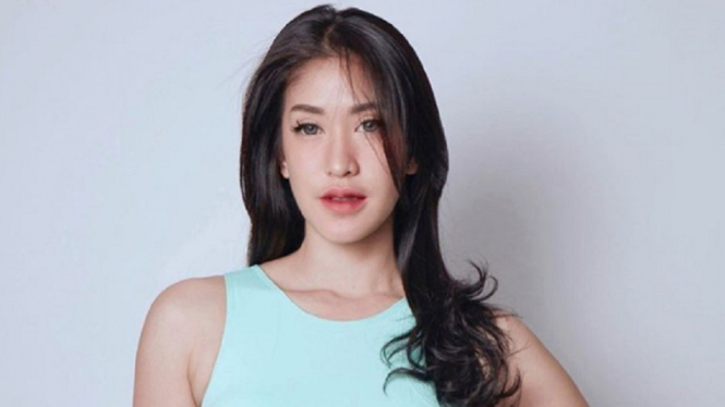 Pose Seksi Berbikini, Elma Agustin Mantan Kevin Aprilio Curi Perhatian (Foto: Instagram/@elmaaa_e)