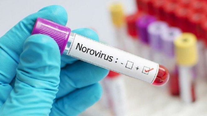 Geger Virus Baru Melanda China, Namanya Norovirus, Begini Gejalanya (Foto Ilustrasi Norovirus)