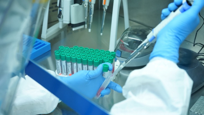 Tingkatkan Pelayanan Swab Test PCR, Laboratorium Biomolekuler Diluncurkan (Foto Ilustrasi Swab Test)