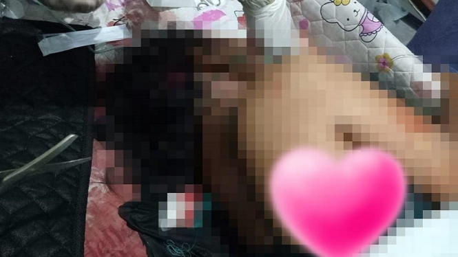 Tragis, Seorang Wanita Hamil Ditusuk Perutnya oleh Seorang Pria Misterius (Foto Instagram Polda Kalteng)