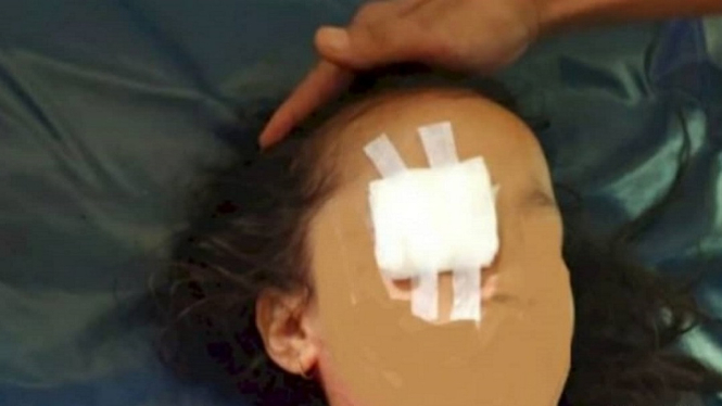 Mengenaskan, Gadis Cilik Usia 6 Tahun Matanya Dicongkel untuk Tumbal Pesugihan (Foto Istimewa)