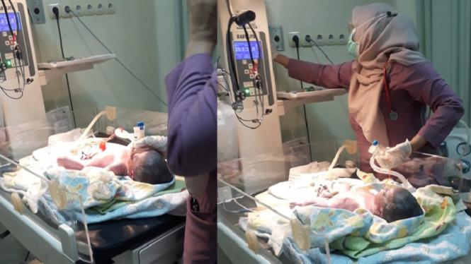 Miris, Bayi Kelainan Paru-Paru Butuh Biaya Pengobatan, 7 Hari Tertahan di Rumah Sakit (Foto Istimewa)