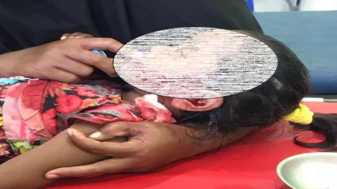 Seorang korban gigitan anjing dilarikan ke Pusekesmas Taliwang (antv / Irwansyah).