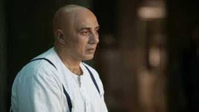 sunny deol bald