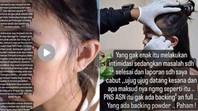 Viral Anak Pejabat Kemendikbud Aniaya Siswi SMA Teman Sekelasnya