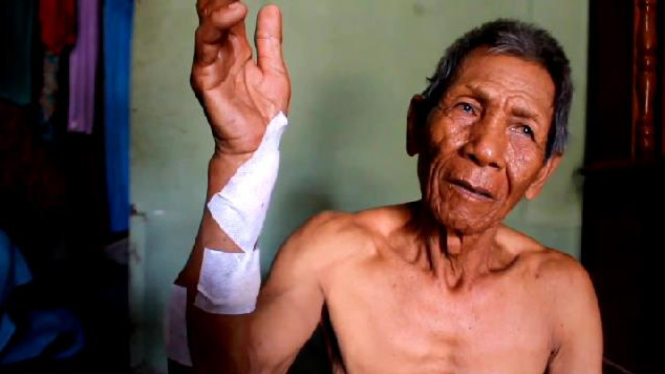 Tragis! Seorang Warga di Lampung Selatan, Digigit Buaya Saat Mencari Rumput di Rawa