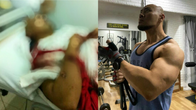 Deddy Corbuzier hoaks dibacok orang