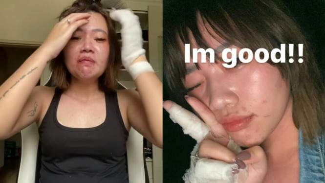 Wendy walters babak belur