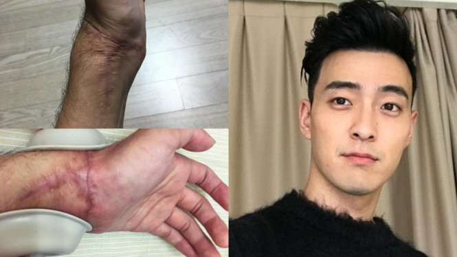 James Lee Royal Pirates