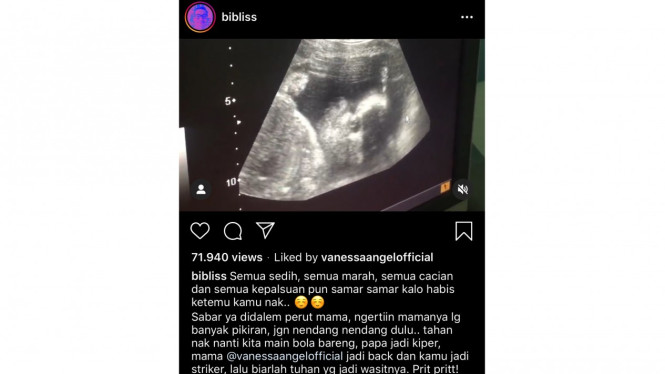 Vanessa Angel dan Bibi Ardiansyah