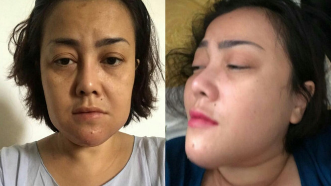 Instagram/@elmatheana