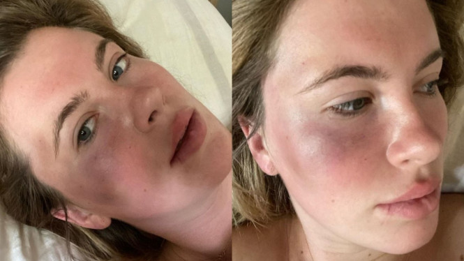 Instagram/irelandbasingerbaldwin