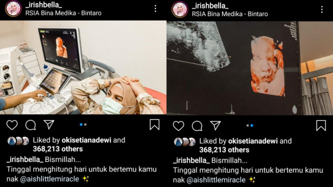 Instagram/_irishbella_