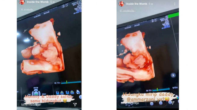 Instagram/aishlittlemiracle