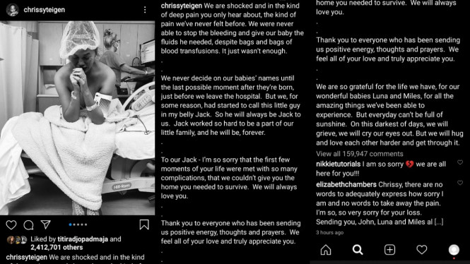 Instagram/chrissyteigen