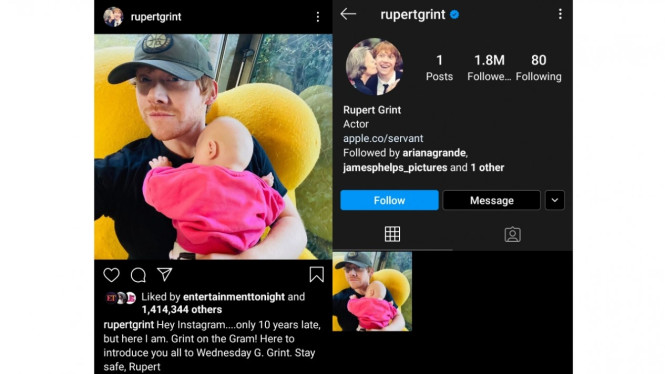 Hamil di Luar Nikah, Rupert Grint Umumkan Nama Bayi Perempuan