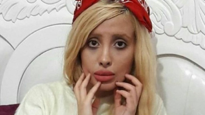 Instagram/sahartabar.before