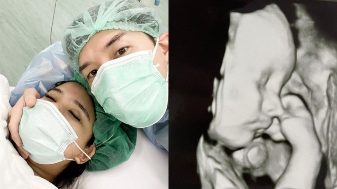 Instagram/audimarissa