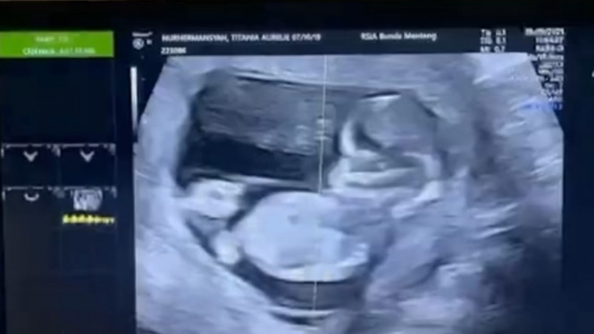 Instagram/attahalilintar