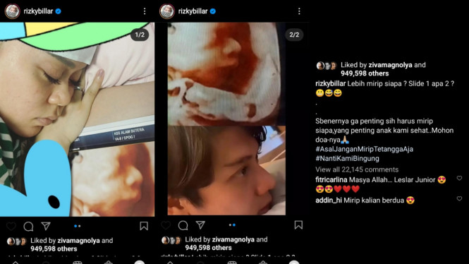 Instagram/rizkybillar