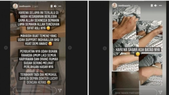 Instagram/medinazein