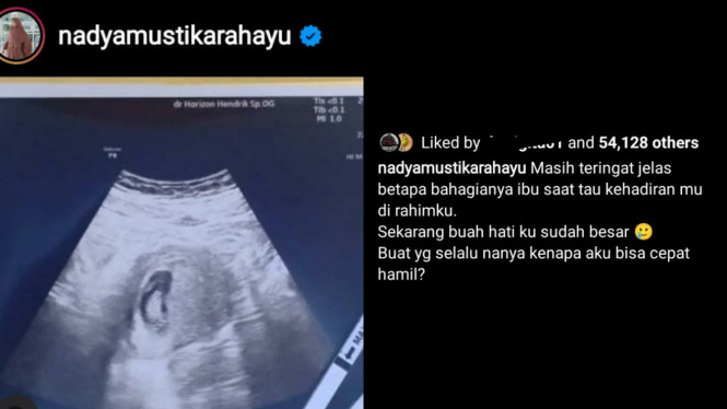 Instagram/nadyamustikarahayu