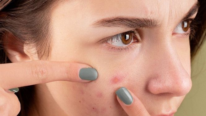 pexels/Anna Nekrashevich