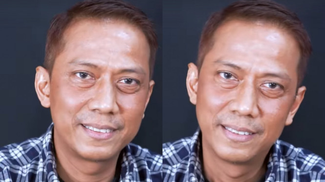 Instagram/dermaprosf