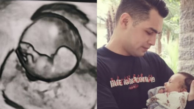 Instagram/jonas.rivanno