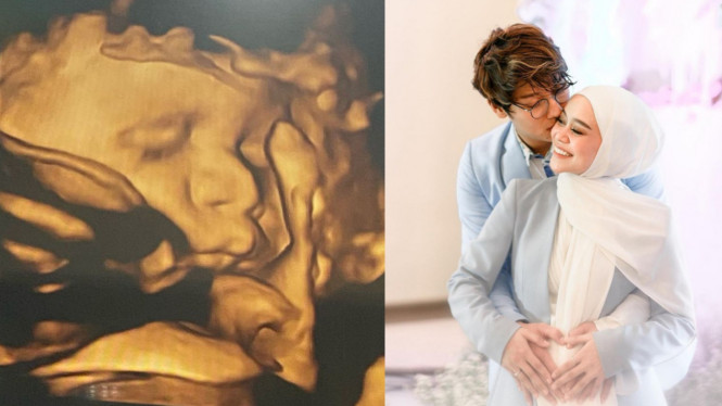 Instagram/@lestykejora