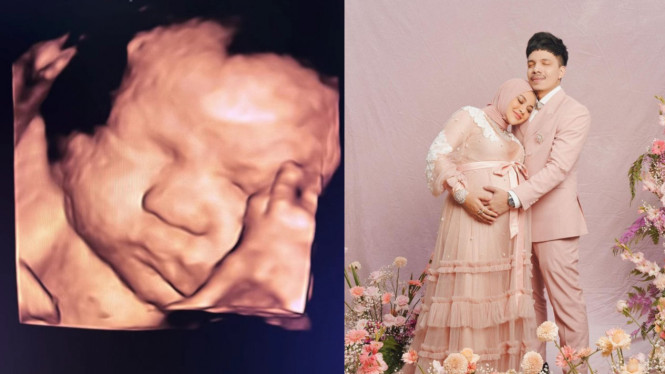 Instagram/@aurelie.hermansyah