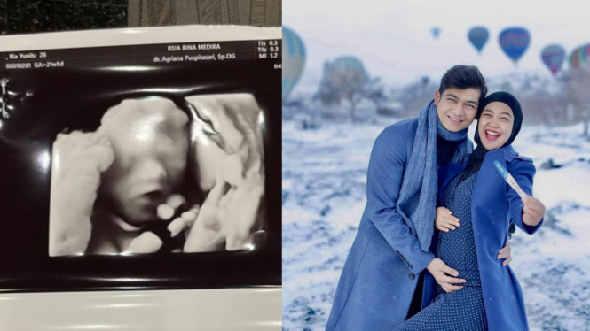 Instagram/@riaricis1795