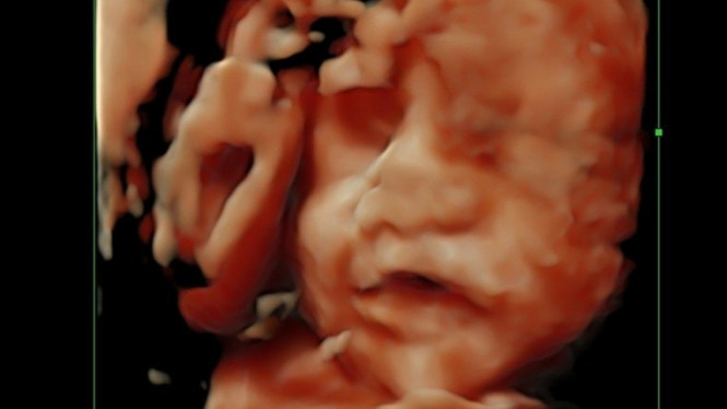 Instagram/faradillayoshi