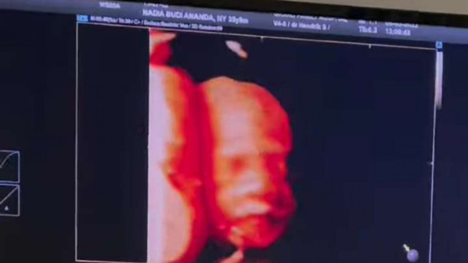 Instagram/@dea_ananda