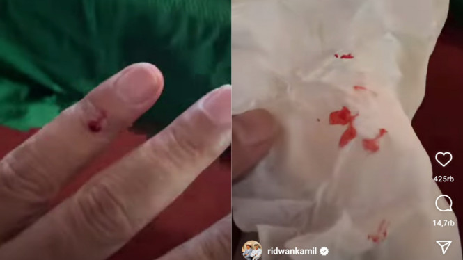 Instagram/ridwankamil 