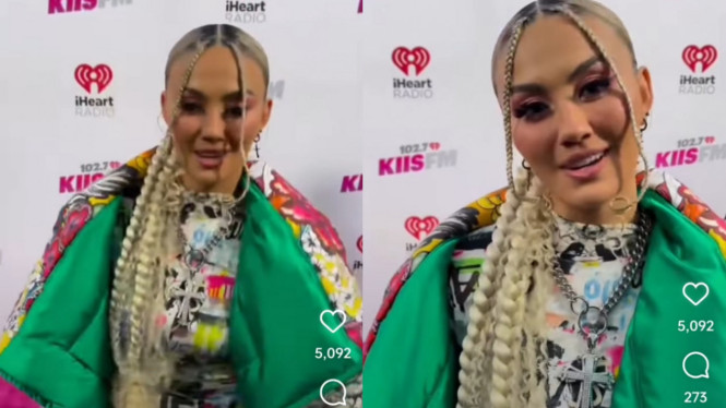 Instagram/agnezmostyle