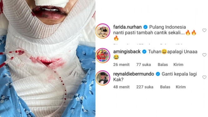 Instagram/lucintaluna_manjalita