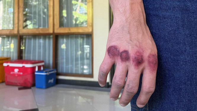 Instagram/jefrinichol