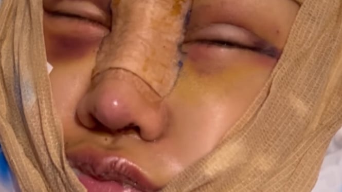 instagram/lucintaluna_manjalita