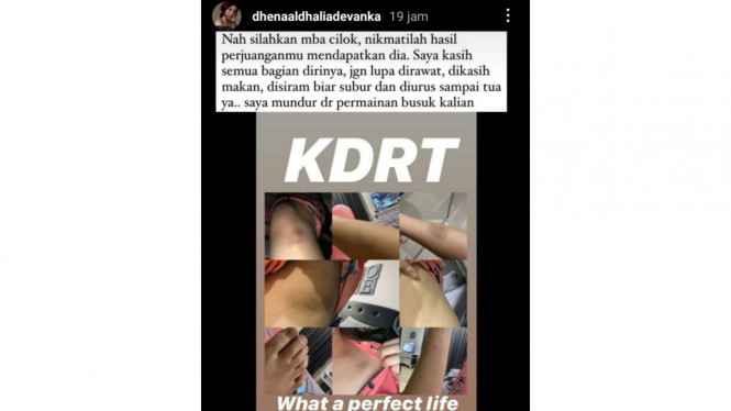 Instagram/@dhenaaldhaliadevanka