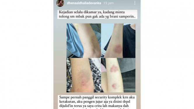 Instagram/@dhenaaldhaliadevanka