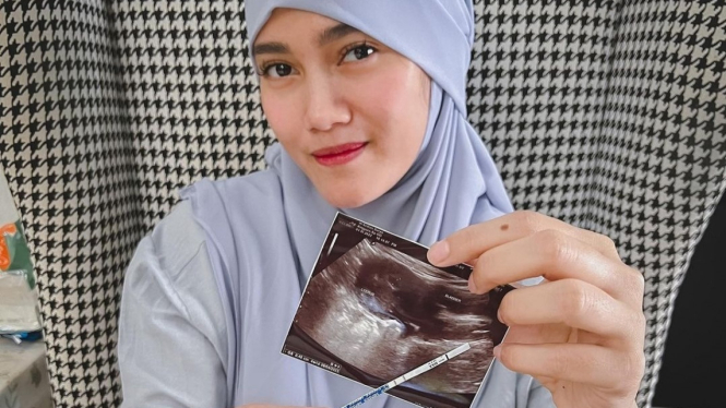 Dikira Masih Gadis, Jess Amalia Beri Kabar Kehamilan Buat Geger