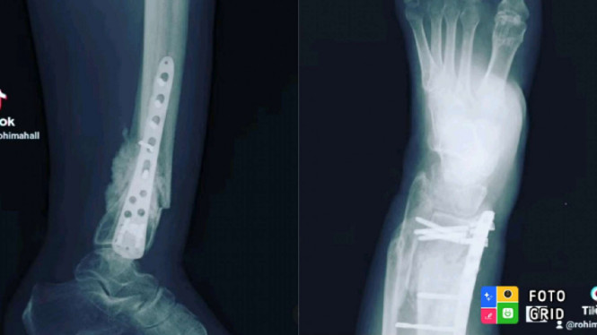 Instagram/@rohimah_alli